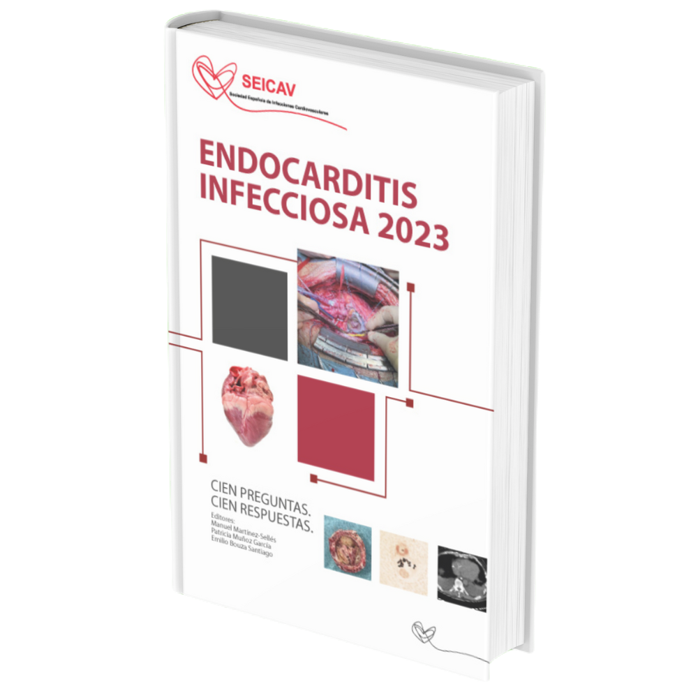 Endocarditis Infecciosa 2023