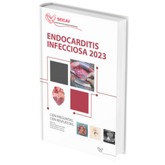 Endocarditis Infecciosa 2023